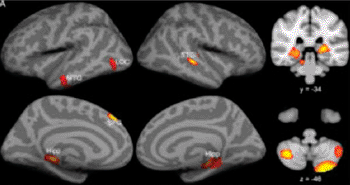 Image: Brain scans show a correlation between how well participants could make a connection between a new word and a sound, and the gray matter volume in the hippocampus and cerebellum (Photo courtesy of Qinghua He).